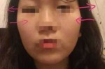五官太大脸太小怎么办,眼小脸大怎么办才能变小