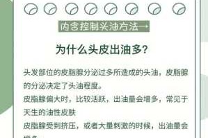 头容易出油怎么办（头容易出油怎么办?）