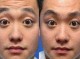 小男孩有抬头纹怎么办,17岁男孩有抬头纹怎么办