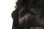 头顶一撮白头发寓意,梦见拔白发是什么意思周公解梦