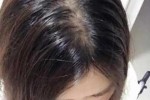为什么自己头发有股香味,头发有腥味是什么原因引起的