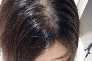 为什么自己头发有股香味,头发有腥味是什么原因引起的
