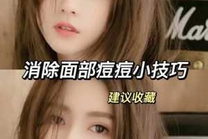 怎么去除脸上长痘痘（怎么去除脸上长痘痘的方法）