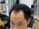 m发际线适合什么发型男（m发型男生怎么剪）