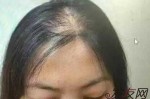 女人为什么会脱发（女人为什么会脱发厉害）