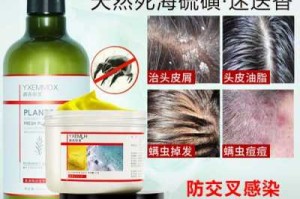 什么能去头屑（什么能去头屑止痒）