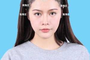 为什么鬓角头发长不长（刘海长得慢是什么原因）