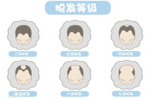 经常悼头发是什么原因（经常悼头发是什么原因近悼头）