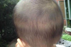 小孩头发不怎么黑，怎么办,