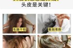 洗头时掉头发怎么办（洗头时掉头发怎么办女性）