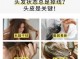洗头时掉头发怎么办（洗头时掉头发怎么办女性）