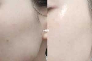 全身皮肤干燥起皮怎么补水最快,皮肤起皮怎么办?