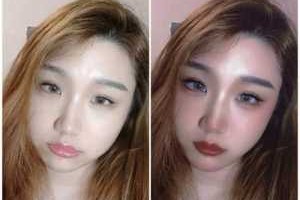 婴儿肥是什么脸型图片（什么是奶膘）