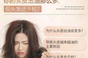 头发不油头皮油怎么办（为什么一些人的头发夏天不油冬天油）