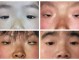 小眼什么（小眼什么意思）