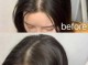 为什么有的人发量多有的人发量少,发量少为什么不能留长发