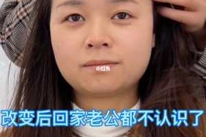 头型特别尖怎么办,额头尖怎么办才能变圆