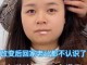 头型特别尖怎么办,额头尖怎么办才能变圆