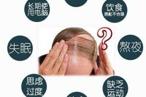 脱发如何解决,落发怎么治啊