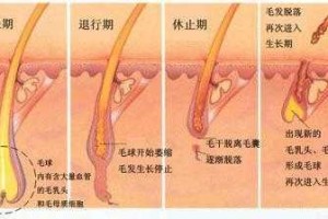 青少年为什么长白头发（青少年为什么长白头发的原因）