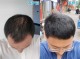 头发稀疏怎么变浓密（头发稀疏怎么变浓密男性）