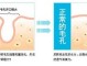 怎么收敛毛孔（如何缩小毛孔）