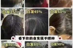 头部白发位置代表什么（头部白发位置代表什么图解）