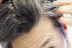 为什么会有青少年有白头发,青少年为什么有白头发,怎样治