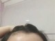 发际线上移怎么办（发际线上移怎么办啊）