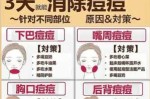 长痘痘怎么消除（消除痘痘的方法）
