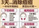 长痘痘怎么消除（消除痘痘的方法）