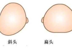 什么样的头型聪明（什么样的头型聪明图像）