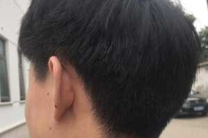 很多白头发是什么原因（后脑勺很多白头发是什么原因）