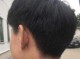 很多白头发是什么原因（后脑勺很多白头发是什么原因）