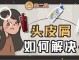 去屑小方法,怎么才能减少头皮屑的方法
