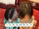 中年妇女掉头发怎么办（中年妇女掉头发怎么办）