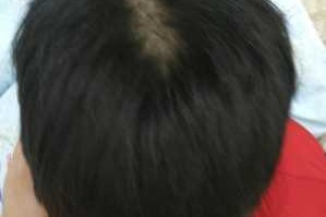 为什么头发不长（为什么头发不长长是什么原因）