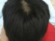 为什么头发不长（为什么头发不长长是什么原因）