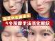 怎么消除眼纹（消除眼纹最快的方法）