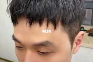 额头两边秃剪什么发型（男士额头两边秃适合发型）