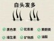 长白头发缺少什么营养（儿童长白头发缺少什么营养）