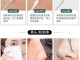 粉刺针挤闭口粉刺方法,怎么用粉刺针去黑头