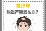 青少年脱发什么原因,青少年脱发是什么原因呢