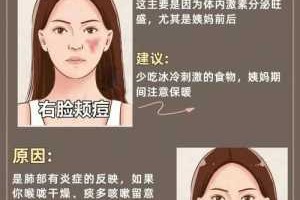 痤疮怎么消除（脸上的痤疮怎么消除）