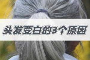 头发变白什么原因（头发变白什么原因引起的）