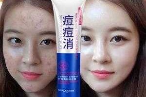 用什么去豆印效果好（去痘印最有效的方法）