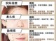 额头上长痘痘是怎么回事,额头两侧长痘痘是什么原因引起的