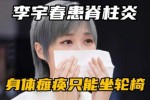 李宇春什么来头,李宇春什么时候得的强直性脊柱炎