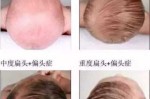 小孩怎么睡觉头型好看（小孩怎样睡觉头型好看）