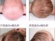 小孩怎么睡觉头型好看（小孩怎样睡觉头型好看）